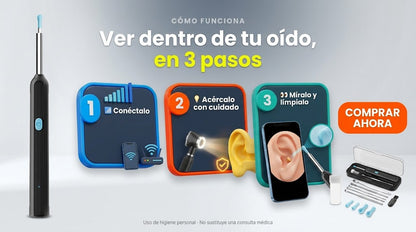 Cámara HD: ve el interior del oído en tu celular